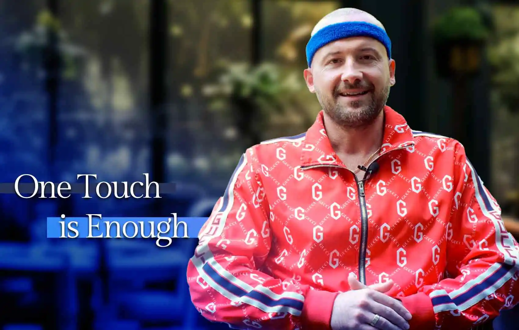 Anton's Hair Transplant Journey