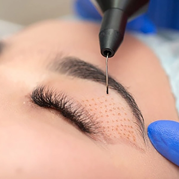 Ameliyatsız Göz Çevresi Uygulamaları