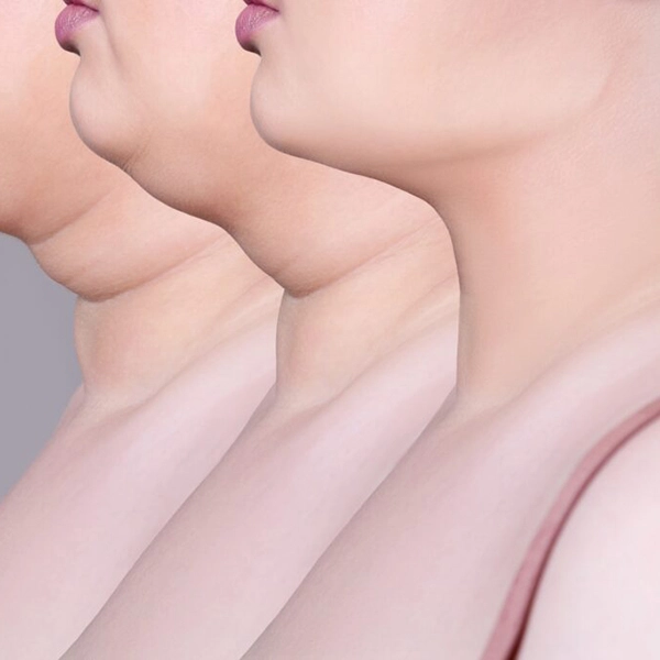 Gıdı Gençleştirme