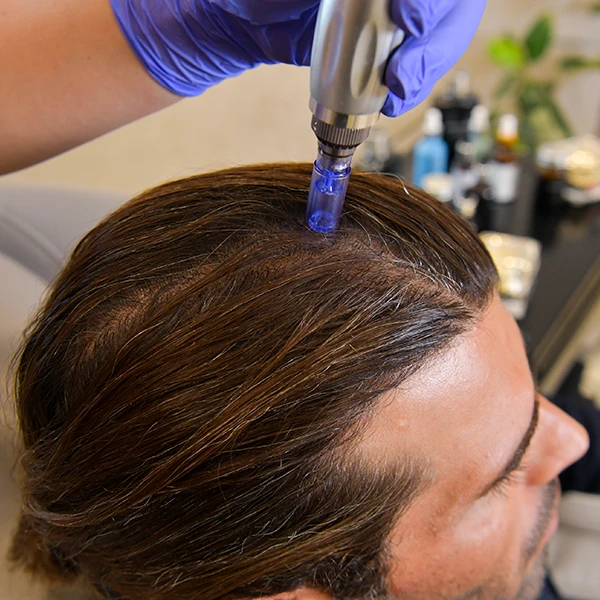 Ekmeden Saç Çoğaltma