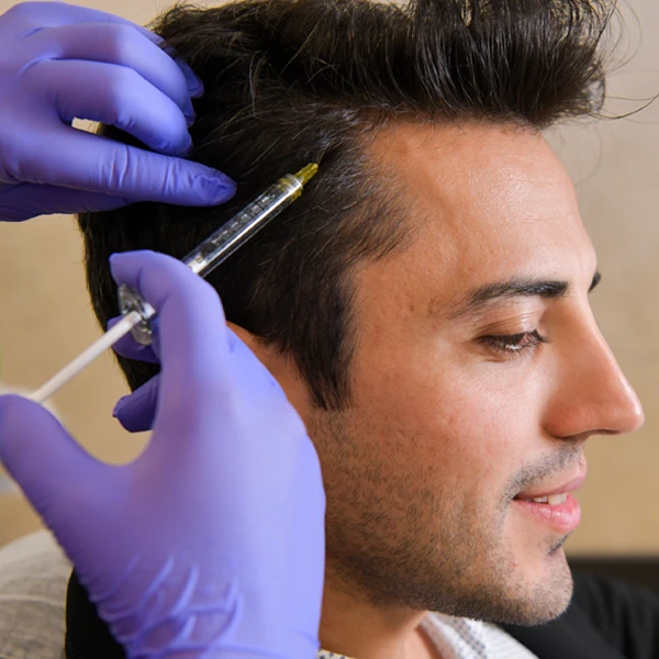 Saç Dökülmesi Tedavisi