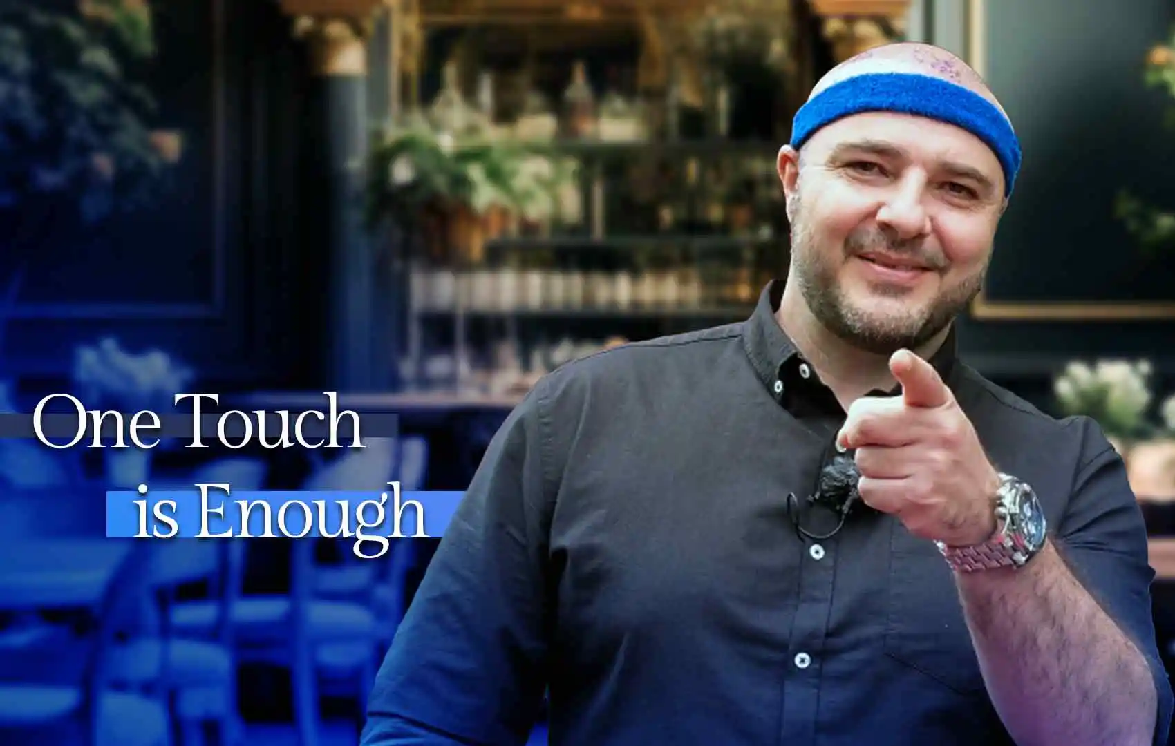 Yasser's Hair Transplant Journey